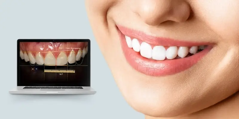 Digital Smile Design Makeover