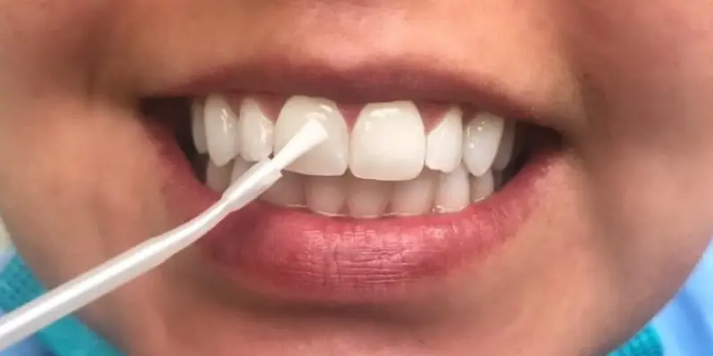 white spot removal